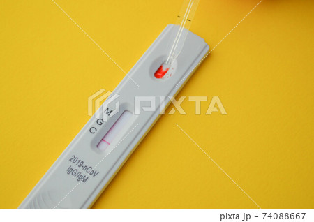 test for coronavirus lies on a yellow background. a drop of venous blood is dripped onto the test strip. medical laboratory, express diagnostics of coronavirus 74088667