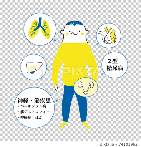 Illustration of an underlying disease modeled on a senior man 74103962