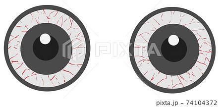 まん丸な充血している瞳セット まん丸な充血している瞳セット 74104372