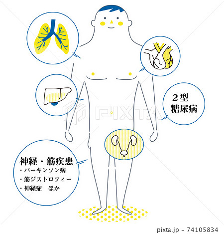 働ぎ盛りの基礎疾患説明図 イラストのイラスト素材