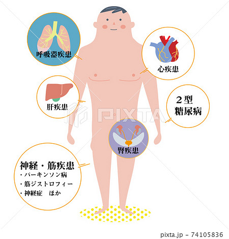 働ぎ盛りの基礎疾患説明図 イラストのイラスト素材