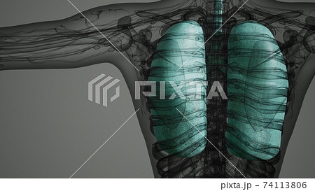 Human Lungs Radiology Exam 74113806