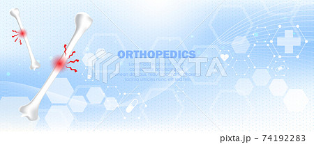 Medical orthopedic abstract background. Treatment for orthopedics traumatology of humerus bones and joints injury. Medical presentation, hospital. Vector illustration	 74192283