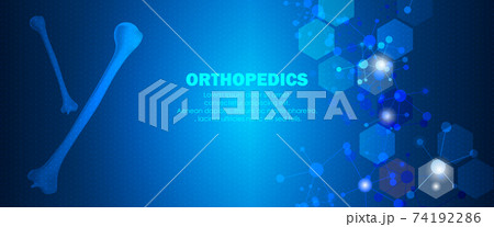 Medical orthopedic abstract background. Treatment for orthopedics traumatology of humerus bones and joints injury. Medical presentation, hospital. Vector illustration	 74192286