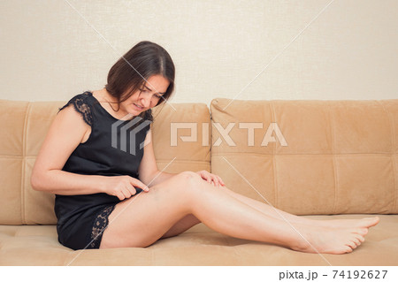 Brunette woman touches painful bruises on her leg while sitting on sofa Brunette woman touches painful bruises on her leg while sitting on sofa 74192627