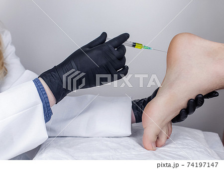 An orthopedic surgeon gives an injection in the heel to relieve pain from a heel spur. The concept of medical care and non-surgical treatments. 74197147