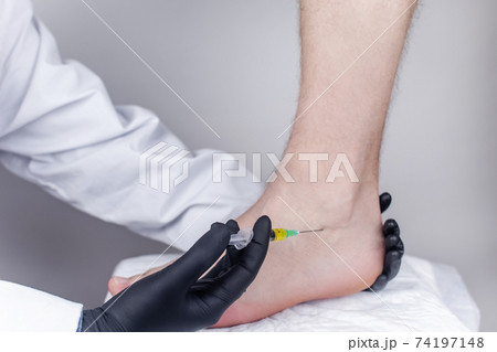 An orthopedic surgeon injects medicine into the Achilles tendon to relieve pain. Help treat sprains, trauma or injury. 74197148