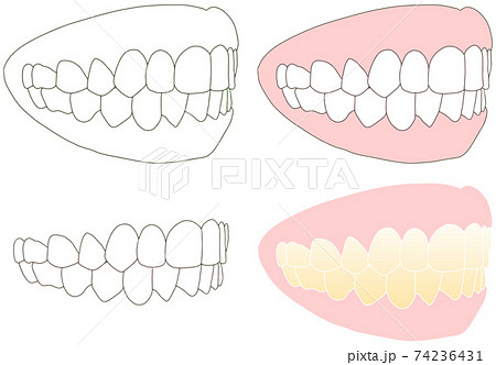 正しい歯並びで口を閉じた斜め 横向きセットのイラスト素材
