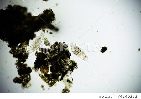 Microscopic Rotifer or Rotifera under a microscope, freshwater bentic organism filtering water. 74240252