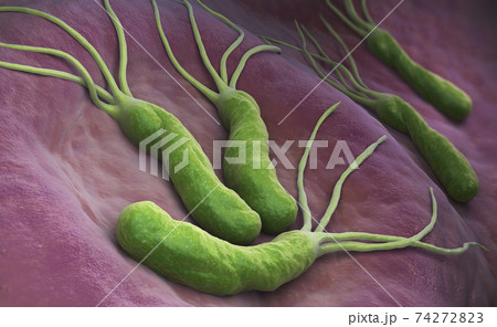 Helicobacter Pylori bacteria 74272823