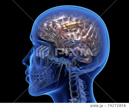 Human head with a bullet inside Human head with a bullet inside 74272858