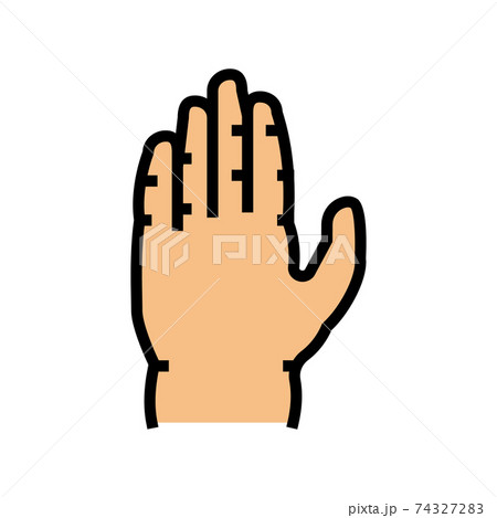 arm edema color icon vector illustration arm edema color icon vector illustration 74327283