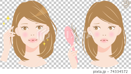 抜け毛 女性 ビフォアアフター 抜け毛 女性 ビフォアアフター 74334572