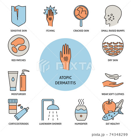 Atopic dermatitis symptoms and treatment banner in line style 74348299