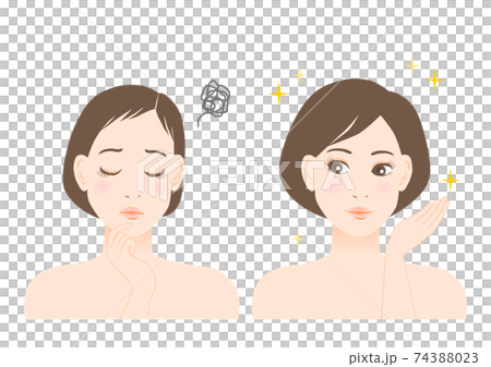 Female Illustrations Thinning Hair Trouble Before After 74388023
