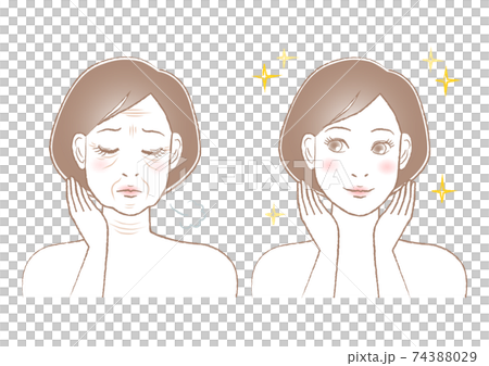 女性 悩み シワ ビフォーアフター イラスト 74388029