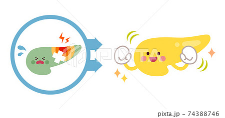 不健康な膵臓から健康な膵臓になるビフォーアフターのイラスト素材 不健康な膵臓から健康な膵臓になるビフォーアフターのイラスト素材