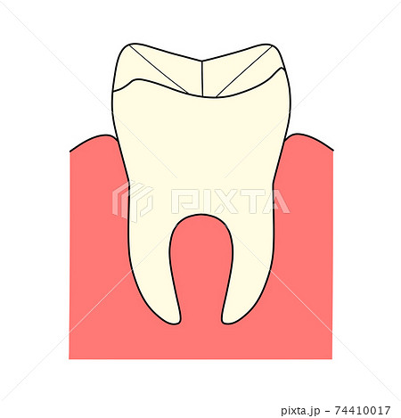 歯と歯茎のイラスト素材