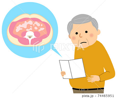 内臓脂肪型肥満の高齢者 74465951