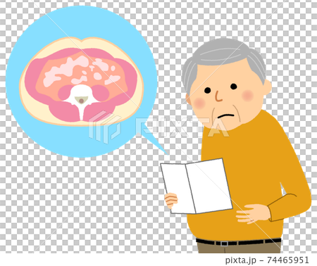 内臓脂肪型肥満の高齢者 74465951
