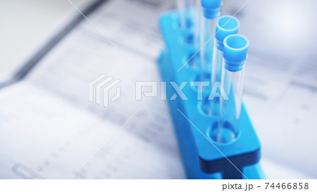 Test tubes on a blue stand against a blurred sheets with test results 74466858