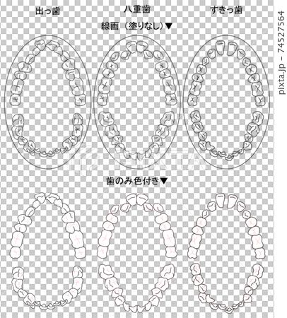 Top view of typical cases targeted for orthodontic treatment Top view of typical cases targeted for orthodontic treatment 74527564
