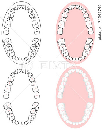 正しいきれいな歯並びを上から見た図セット 74542740
