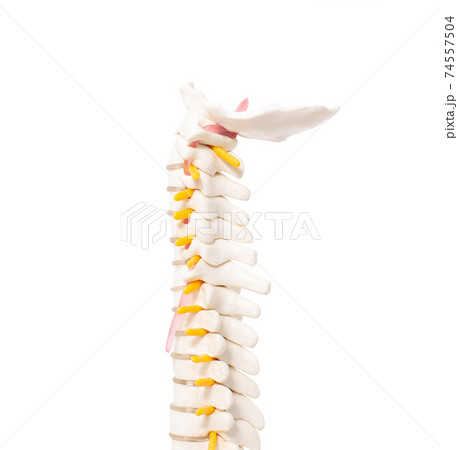 cervical and thoracic spine on a white background, isolate. Osteochondrosis and degenerative changes in the spine, microspondylia cervical and thoracic spine on a white background, isolate. Osteochondrosis and degenerative changes in the spine, microspondylia 74557504