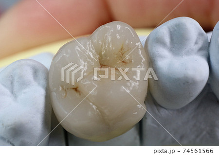 歯 歯 74561566