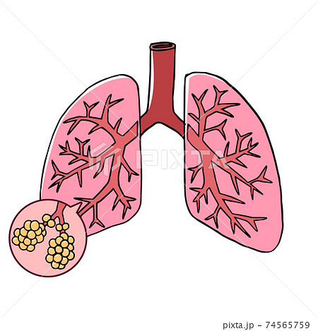 肺と肺胞のイメージのイラスト素材