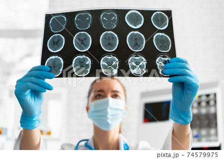 Woman doctor examines head mri scan in hospital 74579975