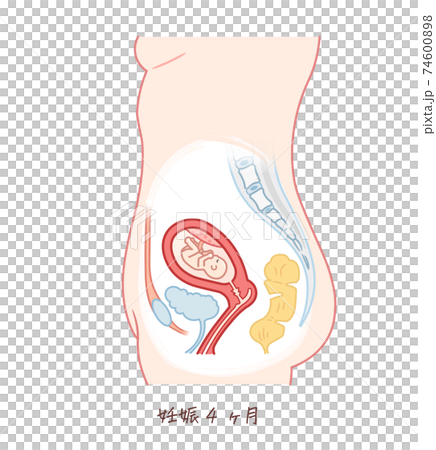 胎兒生長（妊娠4個月） 74600898