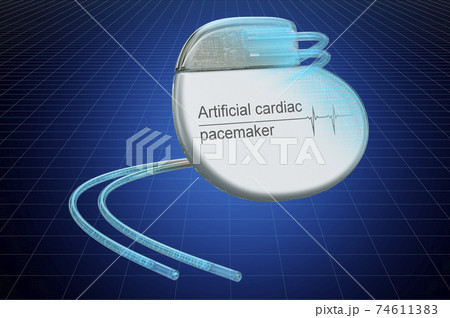Visualization 3d cad model of artificial cardiac pacemaker, blueprint. 3D rendering 74611383