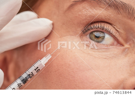 Beautician hands in protective gloves holding syringe near female eye Beautician hands in protective gloves holding syringe near female eye 74613844