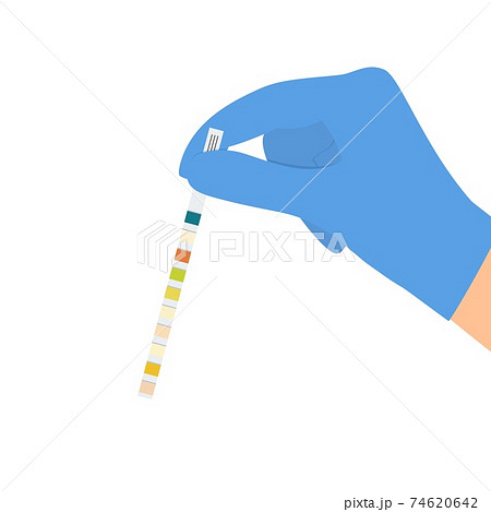 The doctor uses a urine test strip 74620642