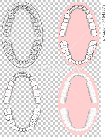 Metal bracket mounting set for correct teeth and backside orthodontics for orthodontics Metal bracket mounting set for correct teeth and backside orthodontics for orthodontics 74642575