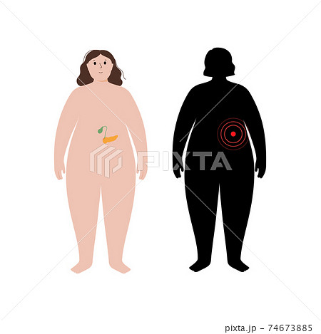 Organs in obese human body Organs in obese human body 74673885