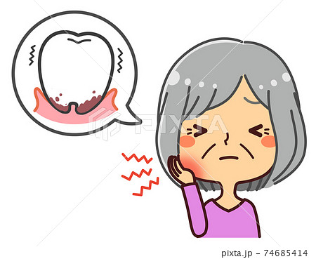 シニア女性　歯周病　イラスト 74685414