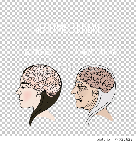 ALZHEIMER DISEASE Dementia Memory Loss Brain Damage Medicine Health Danger Treatment Therapy Banner Poster Hand Drawn Vector Illustration 74722622