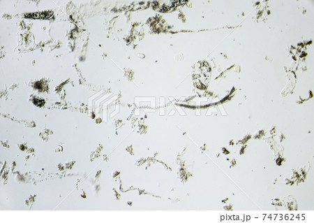 Spirochete, spiral bateria in the center of the photo. Sample taken from the gastrointestinal tract of the Madascar hissing cockroach. Treponema under the microscope with a magnification of 100 times 74736245