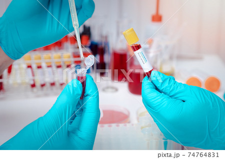 Researchers test blood samples in the laboratory. Researchers are inventing vaccines to treat COVID-19 virus. Researchers test blood samples in the laboratory. Researchers are inventing vaccines to treat COVID-19 virus. 74764831