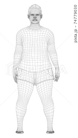 Fat woman, before weight loss 74779030