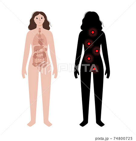 Pain in woman body 74800725