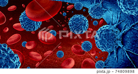 Cancer In The Blood Cancer In The Blood 74809898