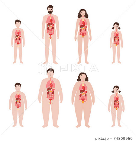 Organs in obese human body 74809966