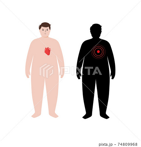 Organs in obese human body 74809968