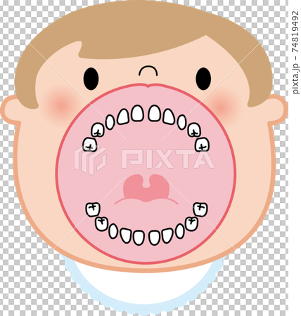 幼児 子供 20本 歯列 口の中 イラスト ベクター 幼児 子供 20本 歯列 口の中 イラスト ベクター 74819492