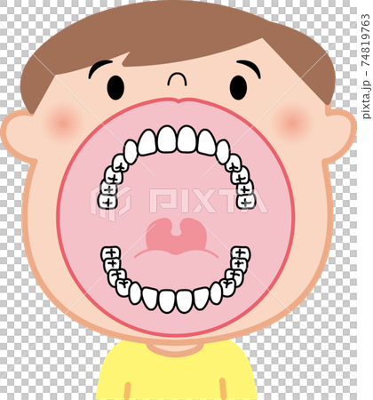 Children's dentition mouth illustration vector - Stock Illustration ...