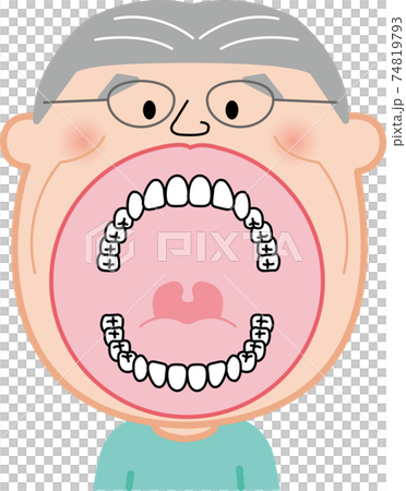 大人 シニア 28本 親知らずなし 歯列 口の中 イラスト ベクターのイラスト素材