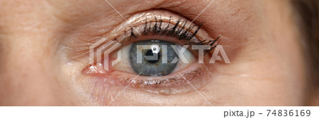 Blue eye of elderly woman look straight. Blue eye of elderly woman look straight. 74836169